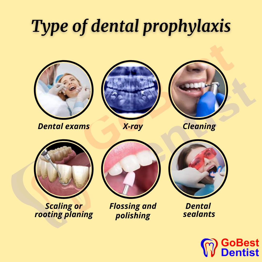 Dental Care and Hygine