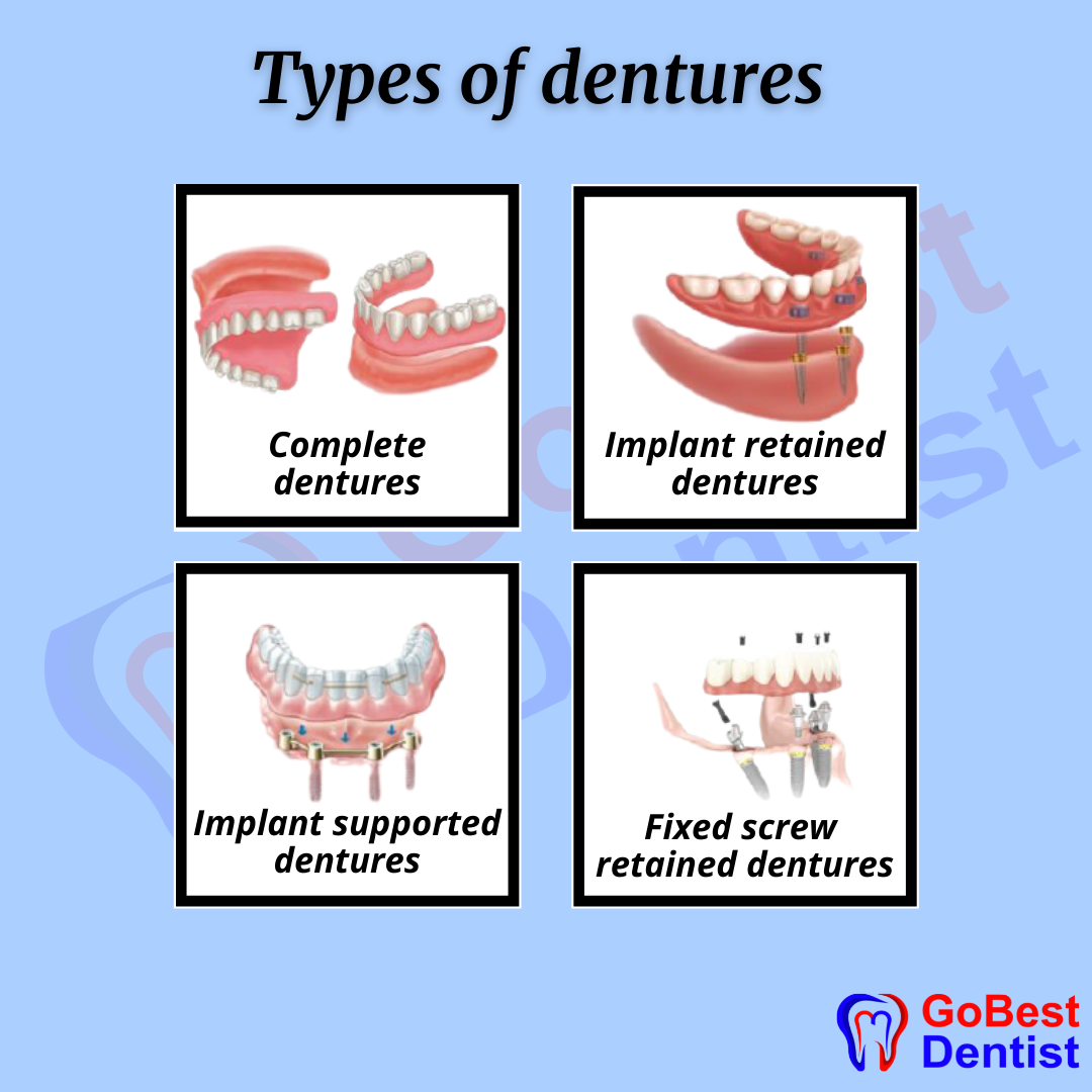 Dentures