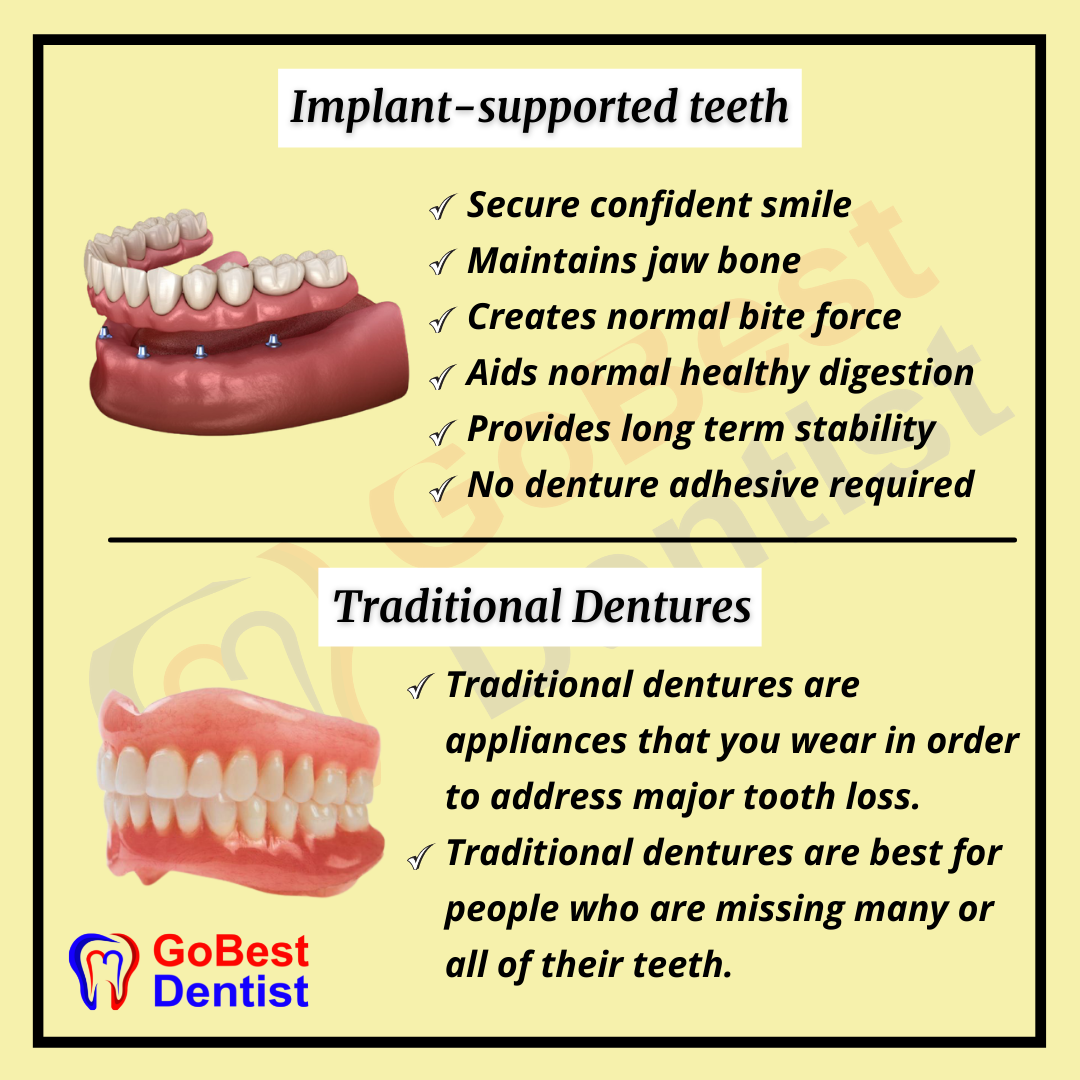 Flexible Partial/Complete Denture