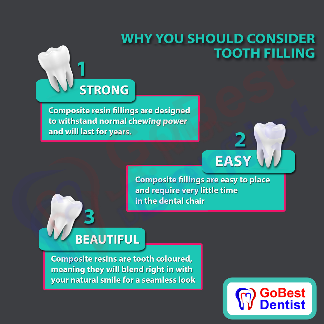 Dental Fillings