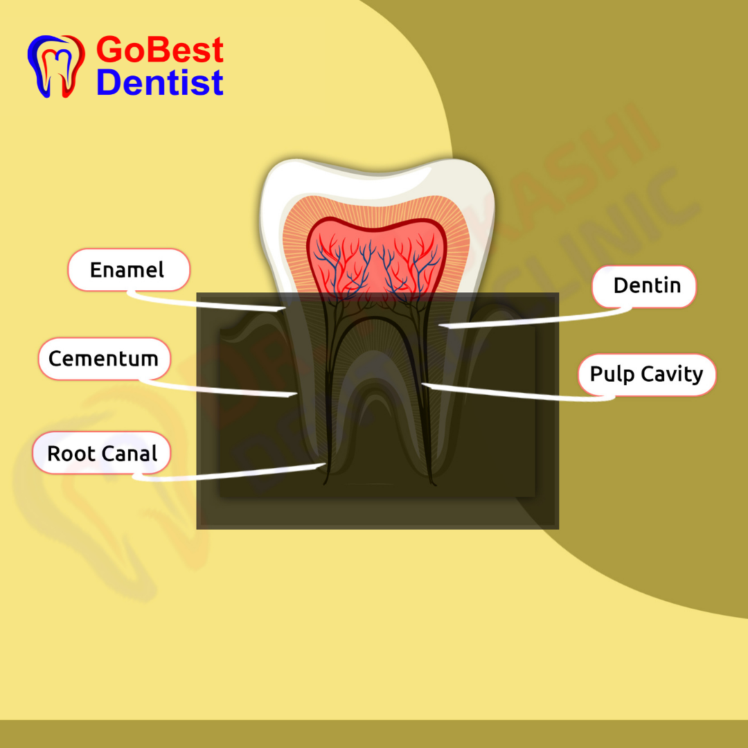 Dental X-Rays