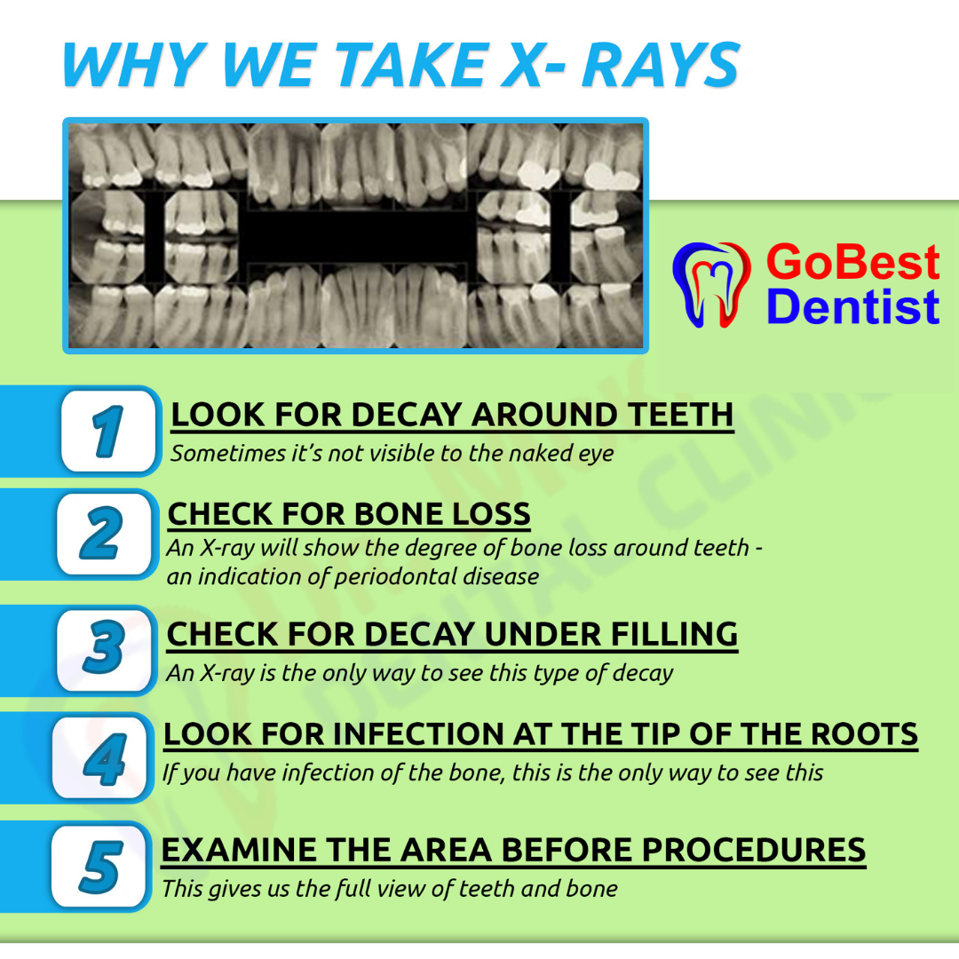 Dental X-Rays