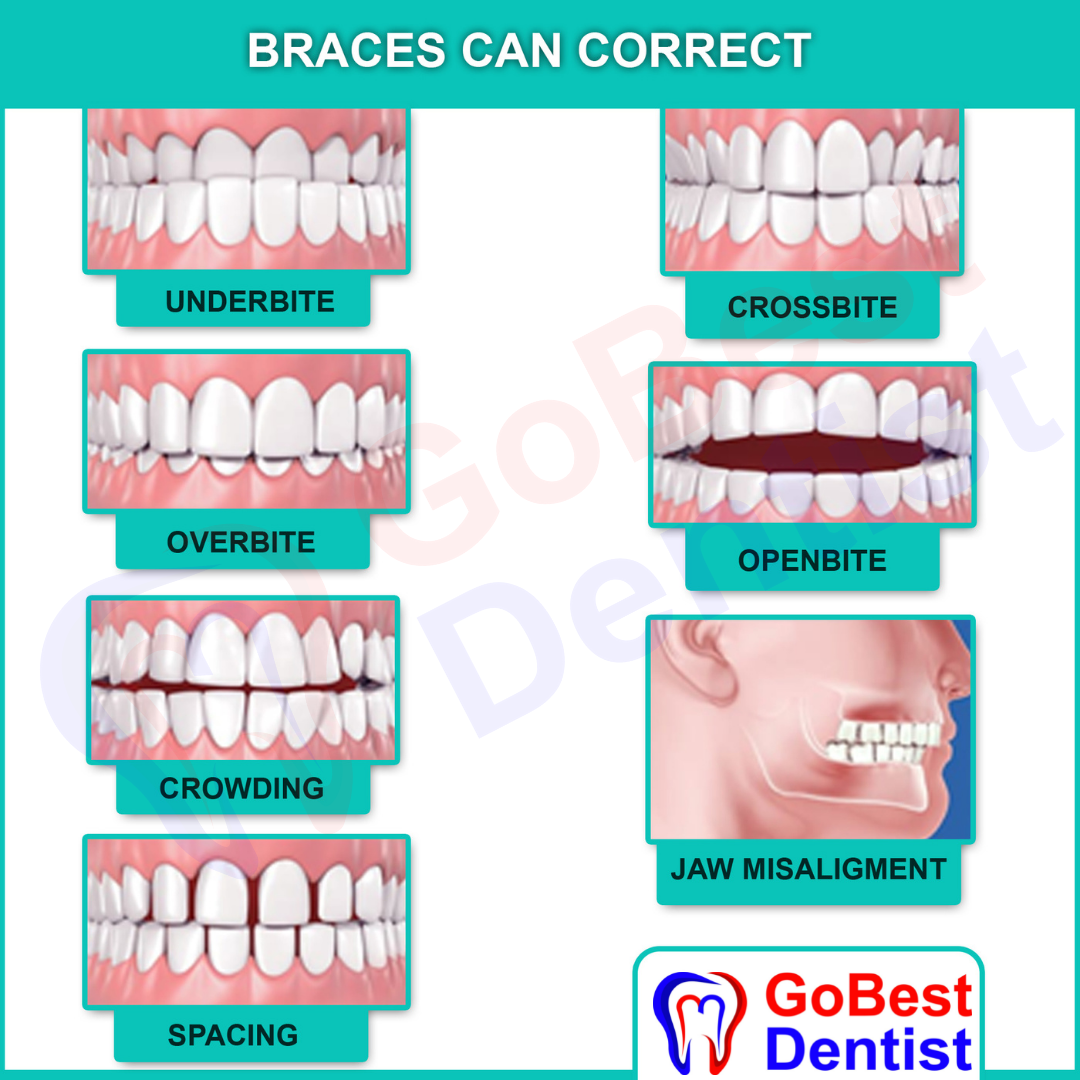 orthodontic