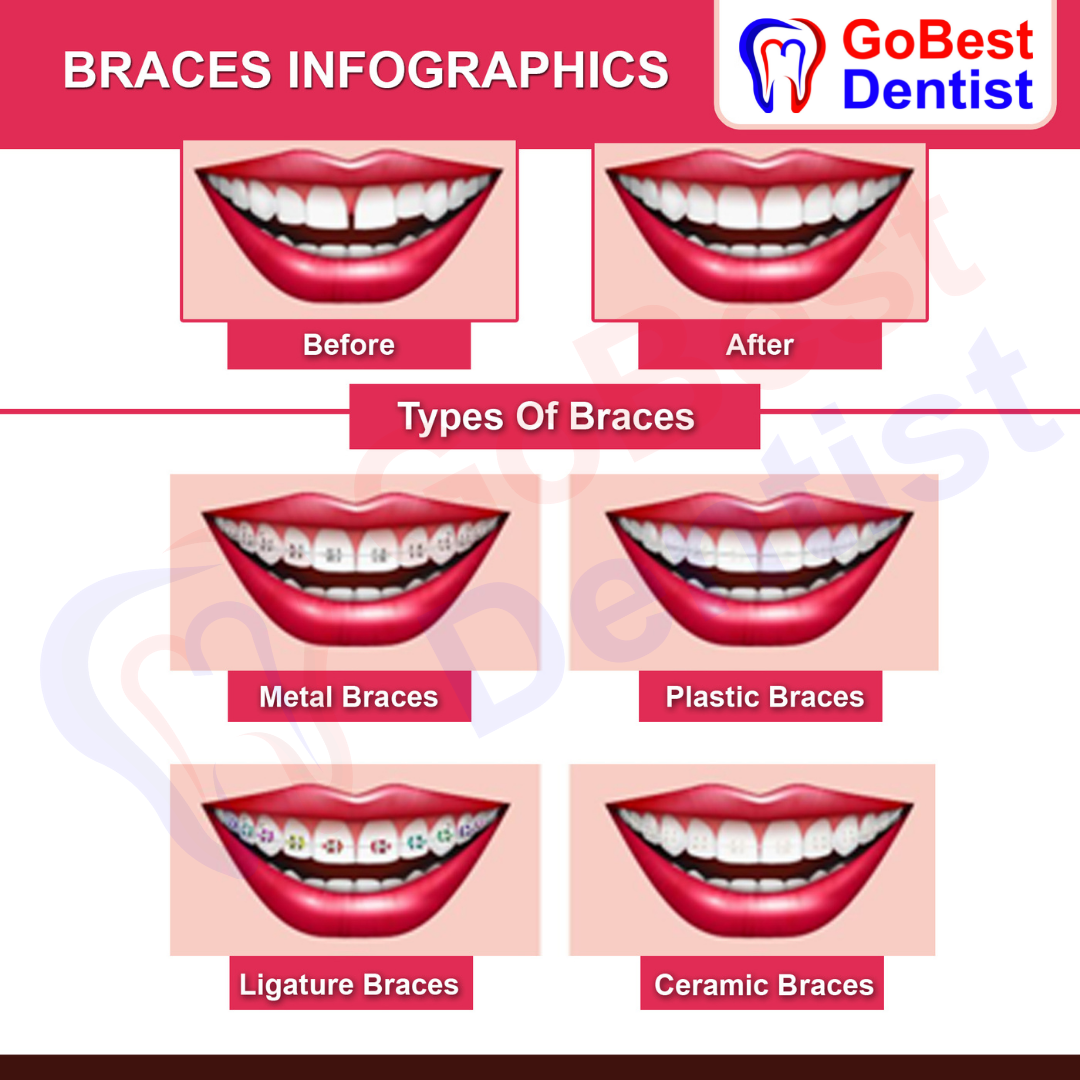 orthodontic